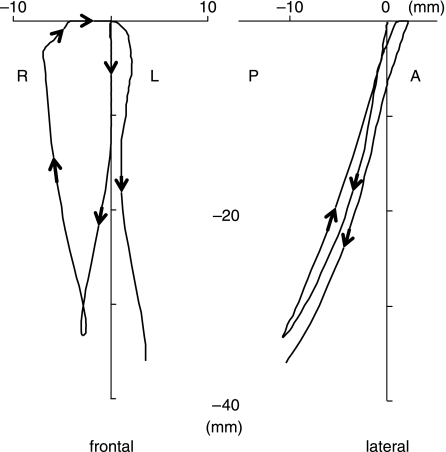 Fig. 2