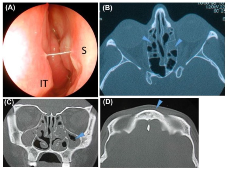 Figure 2