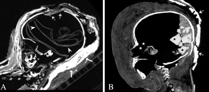 Fig 4