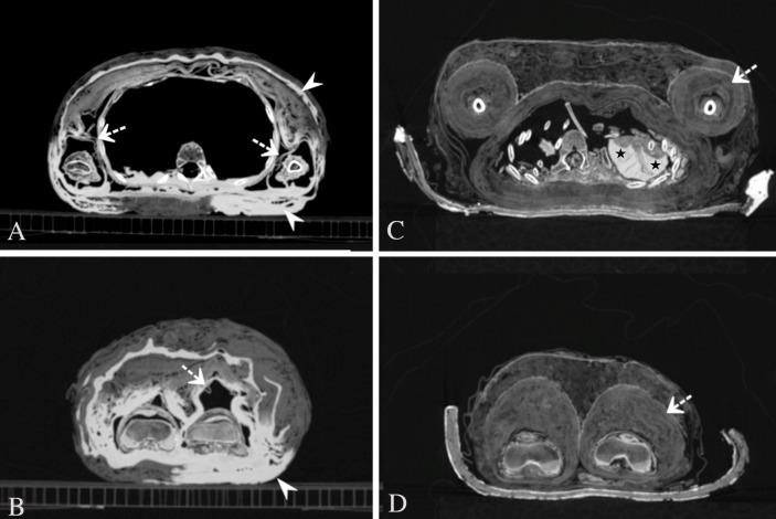 Fig 2