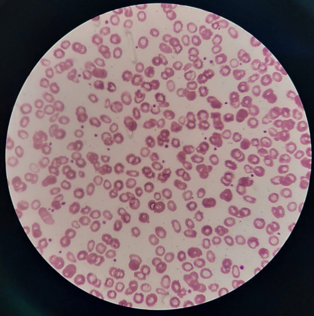 Fig. 2