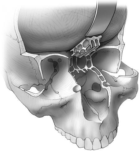 Figure 18