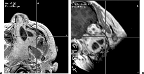 Figure 17