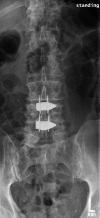 Fig 3a