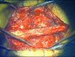 Fig 3e