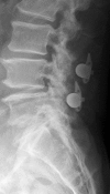 Fig 3b