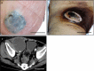Fig. 1