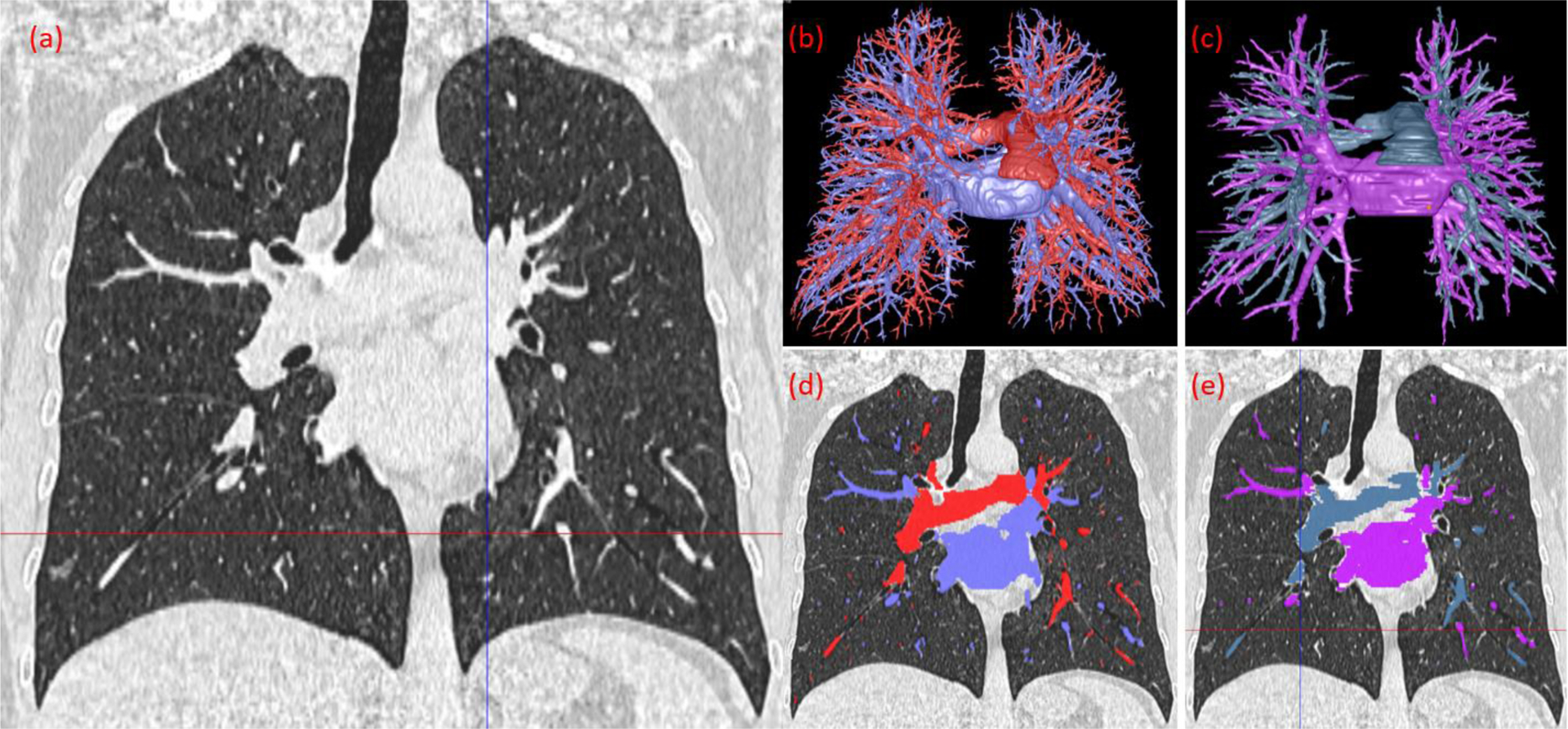 Figure 11.