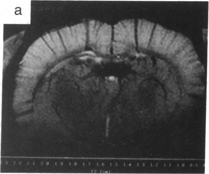 graphic file with name pnas01049-0371-b.jpg