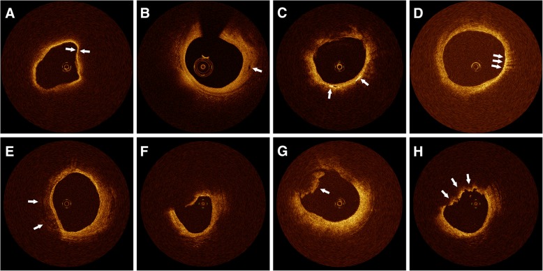 Fig. 2