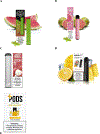 Fig 2.