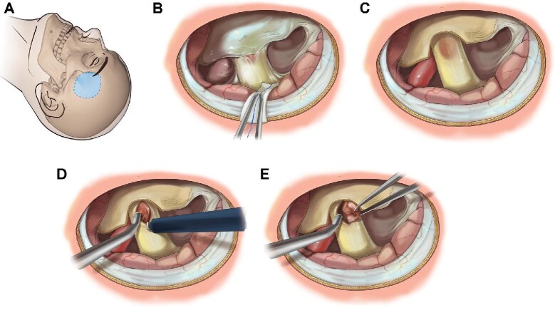 FIGURE 4.