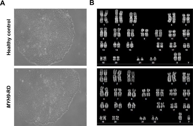 Figure 7—figure supplement 2.