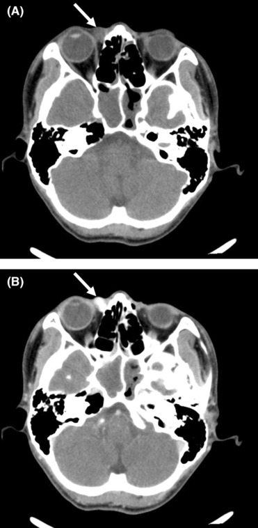 FIGURE 2