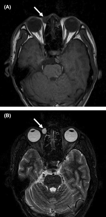 FIGURE 3