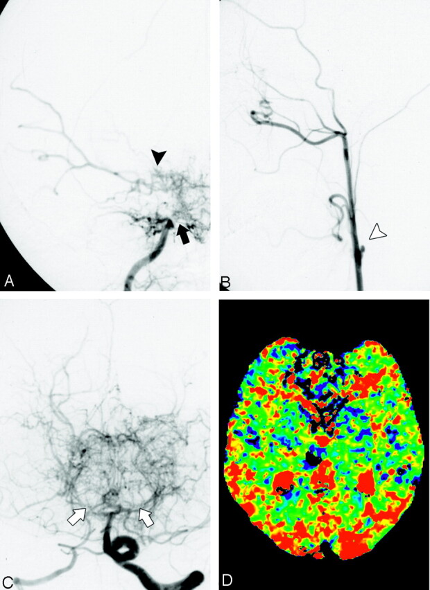 Fig 3.