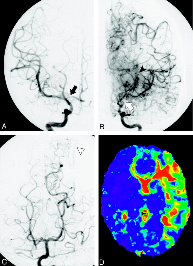 Fig 2.