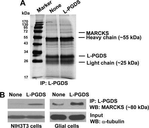 FIGURE 11.