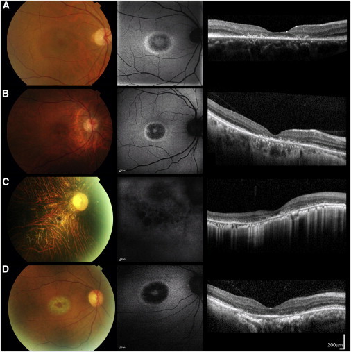 Figure 1