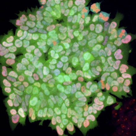 Immunofluorescence staining for two indicators of pluripotency, trimethyl H3K27 and Nanog, in cells that had undergone induced pluripotent stem cell reprogramming.