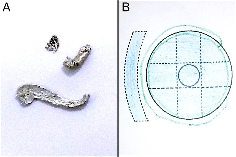 Figure 1