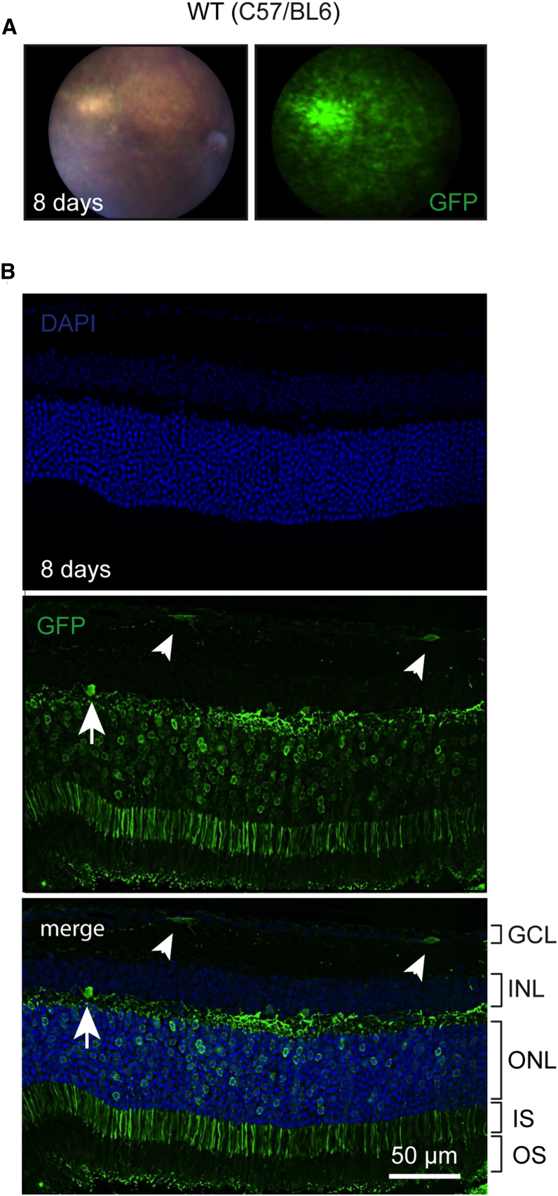 Figure 4