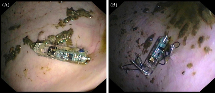 FIGURE 3