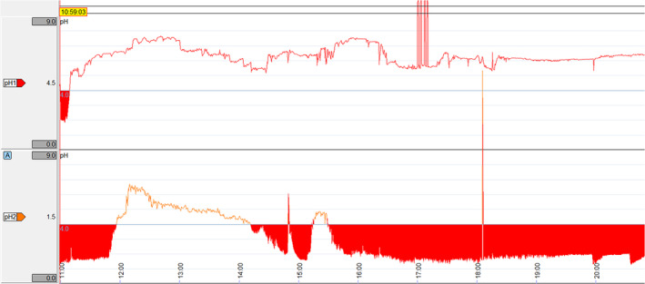 FIGURE 4