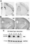 Fig. 14