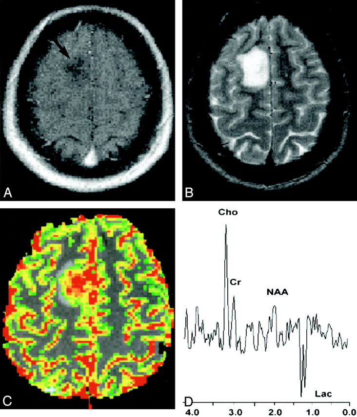 Fig 1.