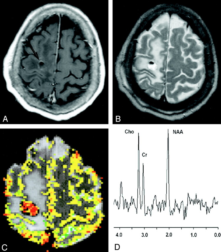 Fig 2.