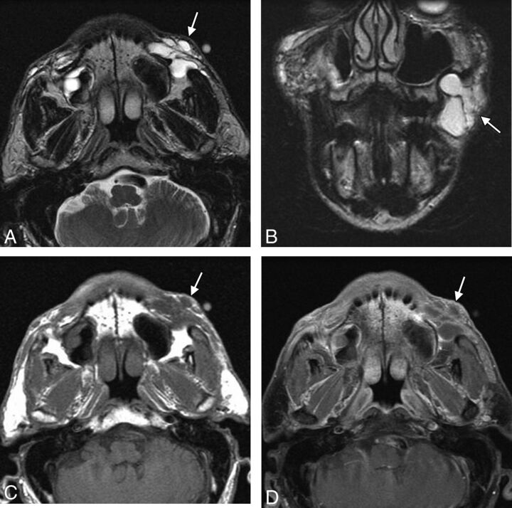 Fig 8.