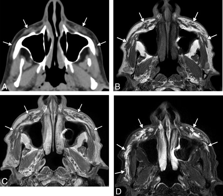 Fig 3.