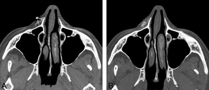 Fig 10.