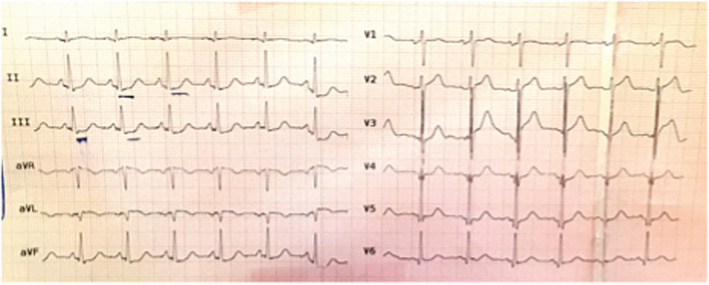 FIGURE 2