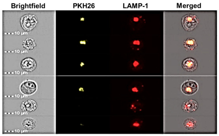 Figure 11