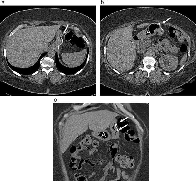 Figure 18. 