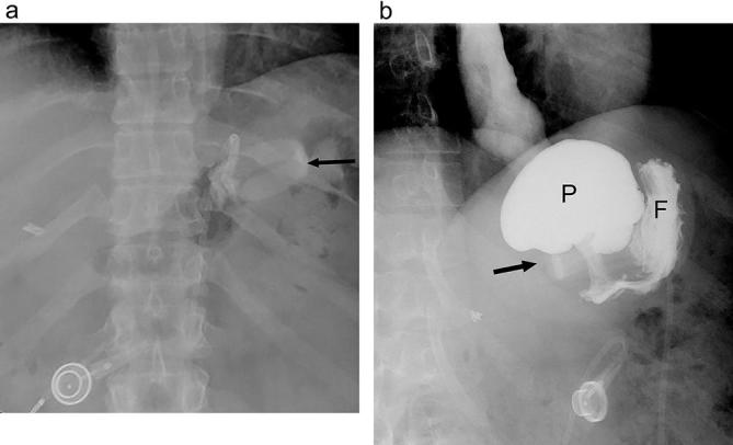 Figure 14. 