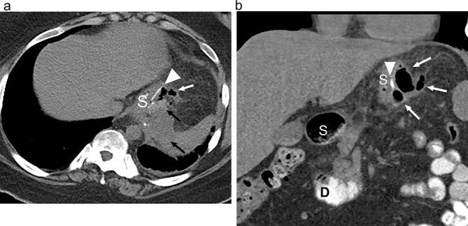 Figure 20. 