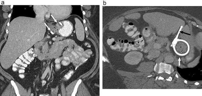 Figure 12. 