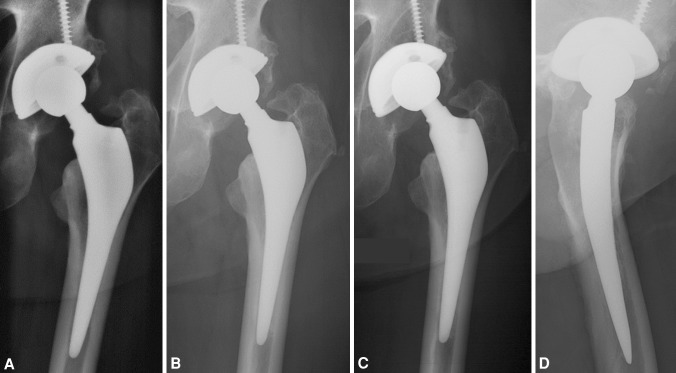 Fig. 3A–D