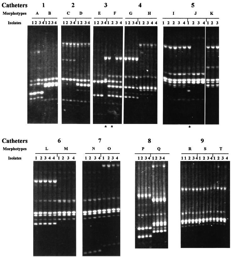 FIG. 1