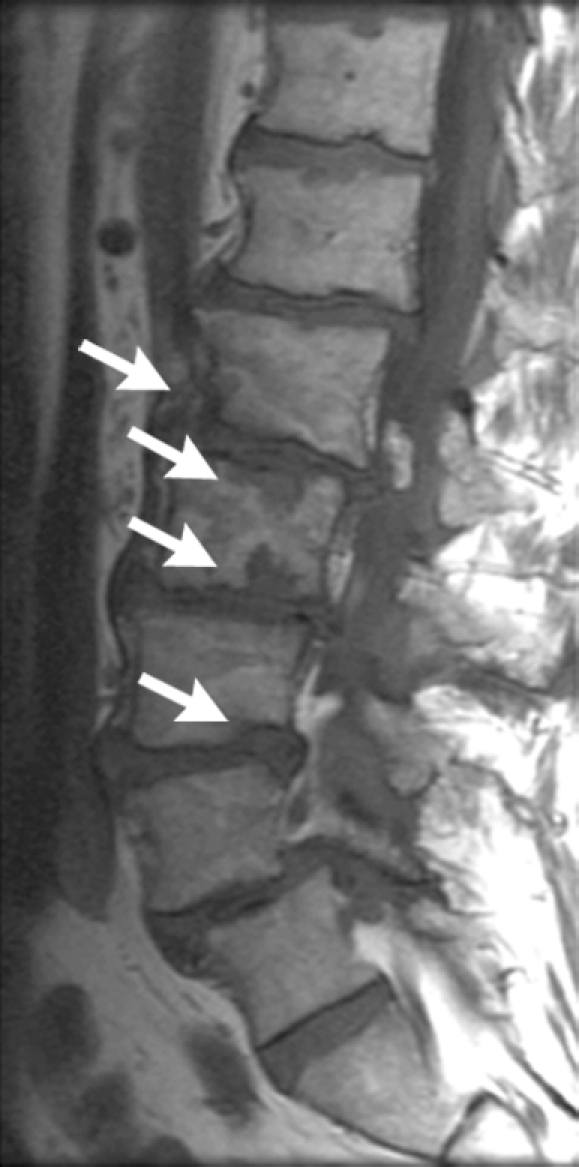 Figure 7d: