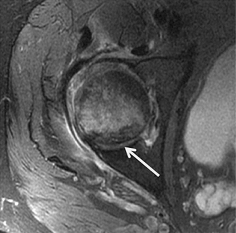 Figure 7c: