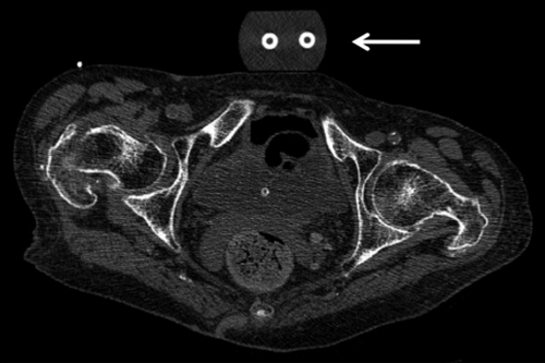 Figure 5: