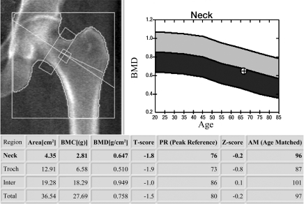 Figure 1a: