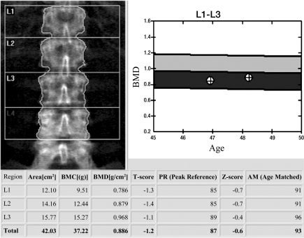 Figure 1b: