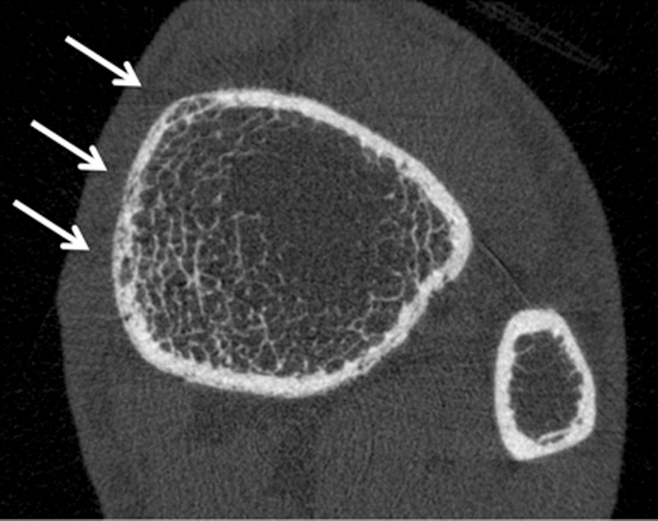 Figure 4b: