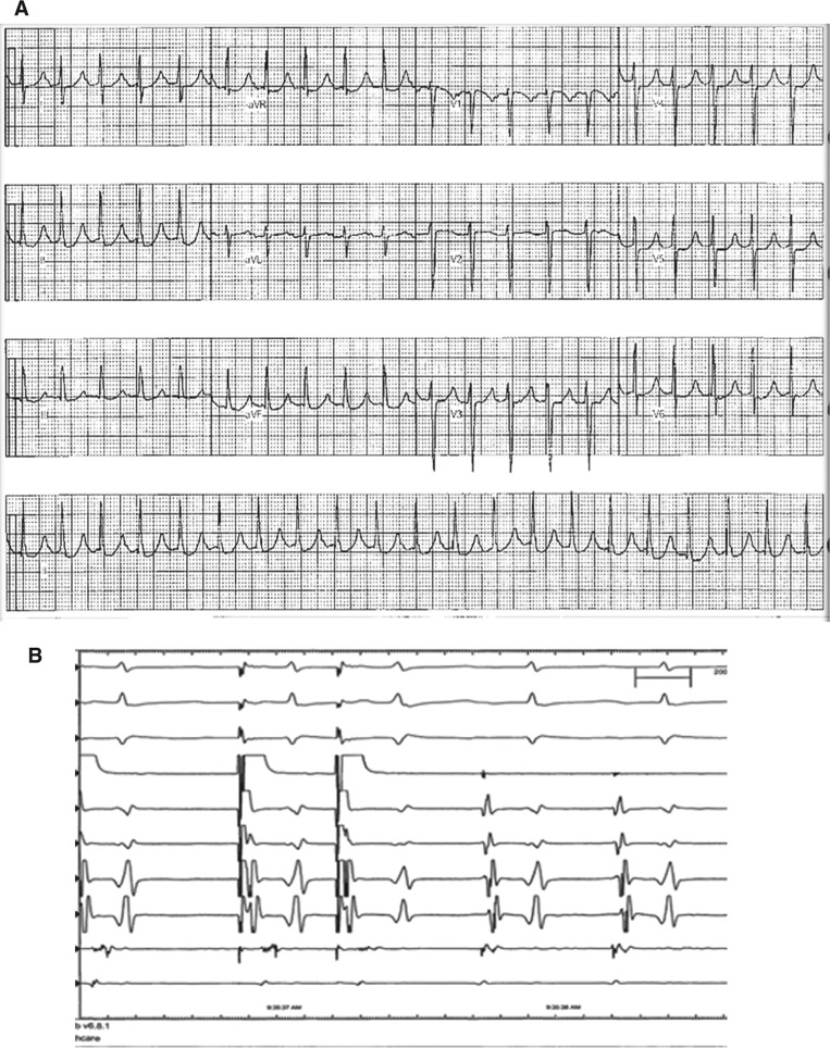 Figure 1: