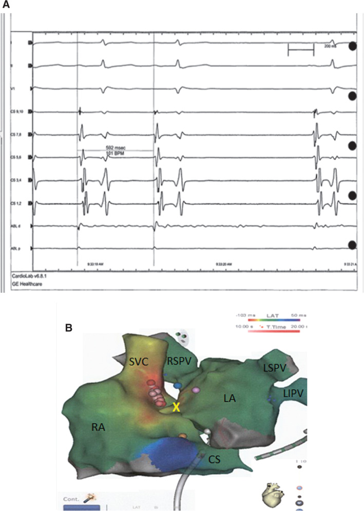 Figure 2: